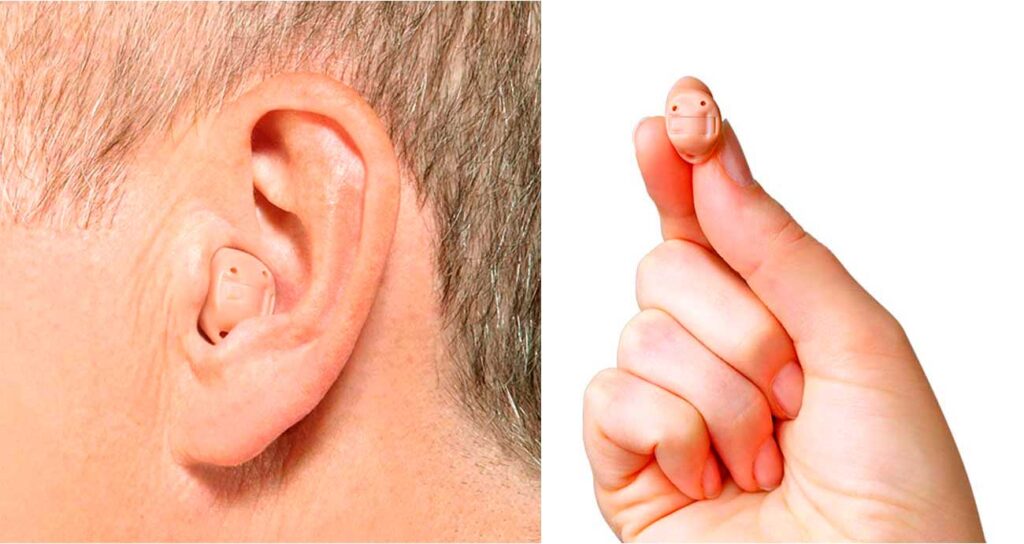 Aparelho Auditivo ITC – Modelo intracanal | Audiograma