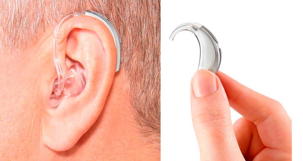 Aparelho Auditivo BTE – Modelo retroauricular | Audiograma